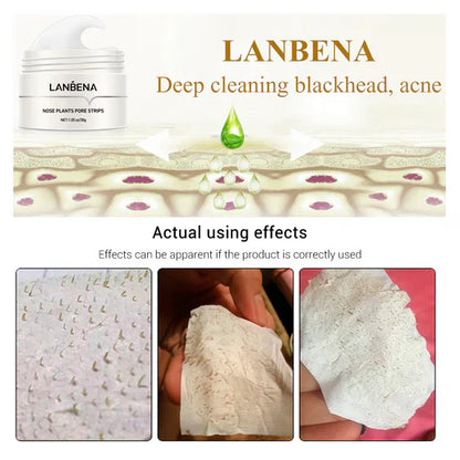 LANBENA™ Instant Blackhead Remover