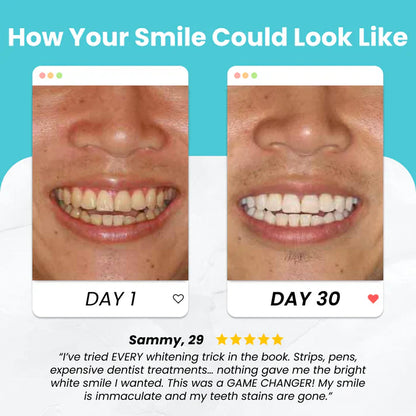 Smart Smile™  Self Brushing Toothbrush